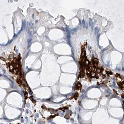 Immunohistochemistry-Paraffin: Thromboxane synthase Antibody [NBP2-33948]