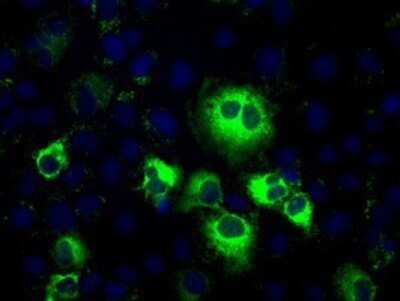 Immunocytochemistry/ Immunofluorescence: Thromboxane synthase Antibody (OTI2C1) - Azide and BSA Free [NBP2-74505]