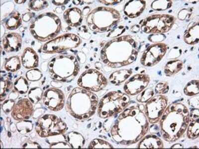 Immunohistochemistry: Thromboxane synthase Antibody (OTI2C1) - Azide and BSA Free [NBP2-74505]