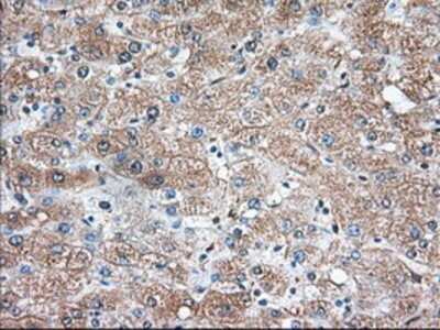 Immunohistochemistry: Thromboxane synthase Antibody (OTI2C1) - Azide and BSA Free [NBP2-74505]