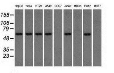 Western Blot: Thromboxane synthase Antibody (OTI2C1)Azide and BSA Free [NBP2-74505]