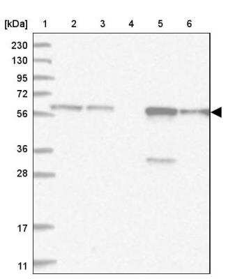 Western Blot: Thromboxane synthase Antibody [NBP2-33948]