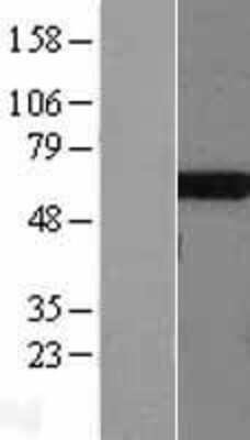 Western Blot: Thromboxane synthase Overexpression Lysate [NBL1-16753]