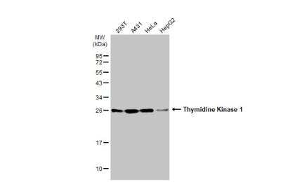 Western Blot: Thymidine Kinase 1 Antibody [NBP2-20626]