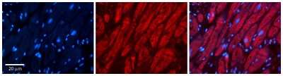 Immunohistochemistry: Thymidine Kinase 2 Antibody [NBP1-79890]