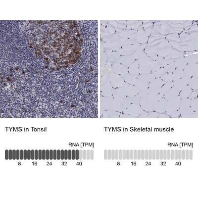 Immunocytochemistry/ Immunofluorescence: Thymidylate Synthase Antibody [NBP3-17004]