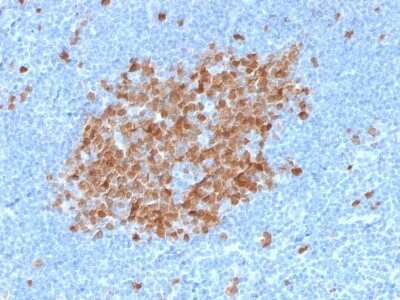 Immunohistochemistry-Paraffin: Thymidylate Synthase Antibody (TYMS/1884) [NBP3-07144]