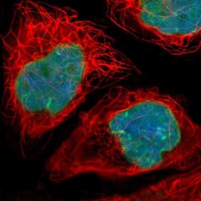 Immunocytochemistry/ Immunofluorescence: Thymopoietin/LAP2 Antibody [NBP1-87822]