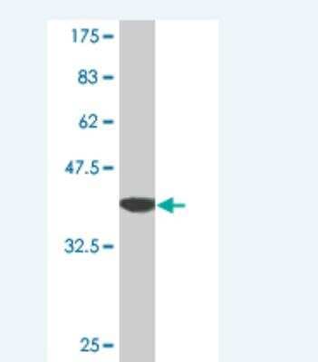 Western Blot: Thymosin alpha 1 Antibody (3E5) [H00005757-M06]