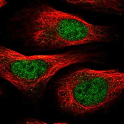 Immunocytochemistry/ Immunofluorescence: Thymosin alpha 1 Antibody [NBP2-14801]