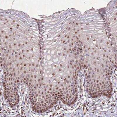 Immunohistochemistry-Paraffin: Thymosin alpha 1 Antibody [NBP2-14801]