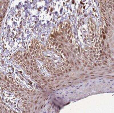 Immunohistochemistry-Paraffin: Thymosin alpha 1 Antibody [NBP2-14801]