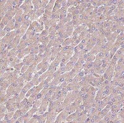 Immunohistochemistry-Paraffin: Thymosin alpha 1 Antibody [NBP2-14801]