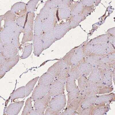 Immunohistochemistry-Paraffin: Thymosin alpha 1 Antibody [NBP2-14801]