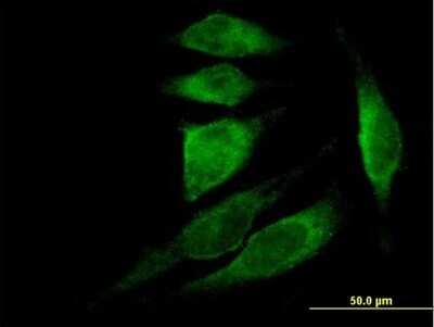 Immunocytochemistry/ Immunofluorescence: Thymosin beta 4 Antibody [H00007114-B01P]