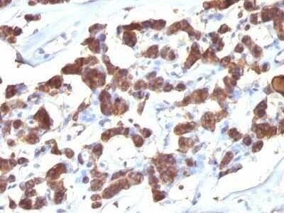 Immunohistochemistry-Paraffin: Thyroglobulin Antibody (2H11 + 6E1) - Azide and BSA Free [NBP2-34530]