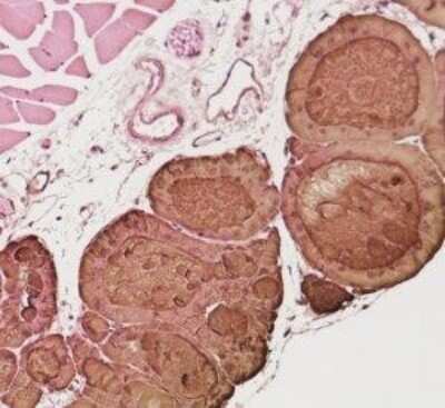 Immunohistochemistry: Thyroglobulin Antibody (2H11 + 6E1) - IHC-Prediluted [NBP2-45121]