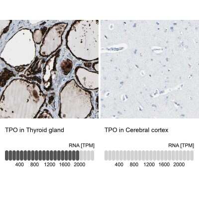Immunohistochemistry-Paraffin: Thyroid Peroxidase Antibody [NBP1-80670]