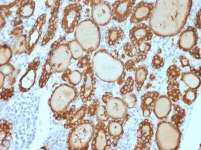 Immunohistochemistry-Paraffin: Thyroid Peroxidase Antibody (TPO/3813R) [NBP3-07738]