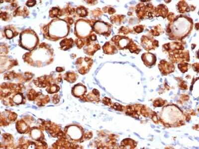 Immunohistochemistry-Paraffin: Thyroid Peroxidase Antibody (TPO/6417R) [NBP3-07739]