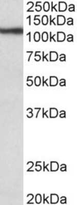 Western Blot: Thyroid Peroxidase Antibody [NBP1-97765]