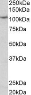 Western Blot: Thyroid Peroxidase Antibody [NBP2-27544]