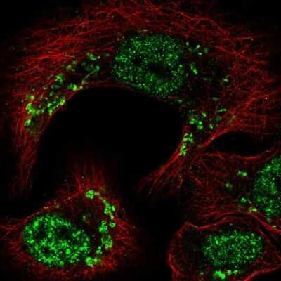 Immunocytochemistry/ Immunofluorescence: Thyroid receptor-interacting protein 11 Antibody [NBP2-57415]