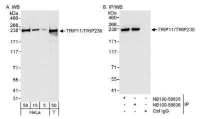 Western Blot: Thyroid receptor-interacting protein 11 Antibody [NB100-59835]