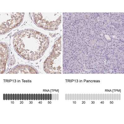 Immunohistochemistry-Paraffin: Thyroid receptor-interacting protein 13 Antibody [NBP2-38690]