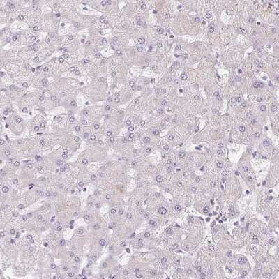 Immunohistochemistry-Paraffin: Thyroid receptor-interacting protein 13 Antibody [NBP2-38690]