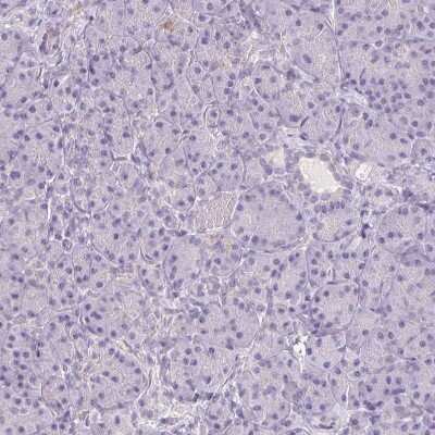 Immunohistochemistry-Paraffin: Thyroid receptor-interacting protein 13 Antibody [NBP2-38690]