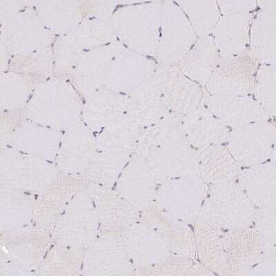 Immunohistochemistry-Paraffin: Thyroid receptor-interacting protein 13 Antibody [NBP2-38690]