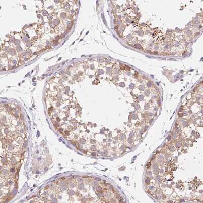 Immunohistochemistry-Paraffin: Thyroid receptor-interacting protein 13 Antibody [NBP2-38690]