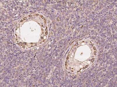 Immunohistochemistry-Paraffin: Thyroid receptor-interacting protein 13 Antibody [NBP2-97950]