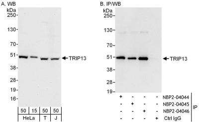 Immunoprecipitation: Thyroid receptor-interacting protein 13 Antibody [NBP2-04046]
