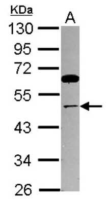 Western Blot: Thyroid receptor-interacting protein 13 Antibody [NBP2-20630]