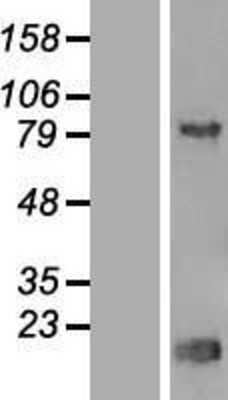 Western Blot: Thyroid receptor-interacting protein 13 Overexpression Lysate [NBP2-10574]