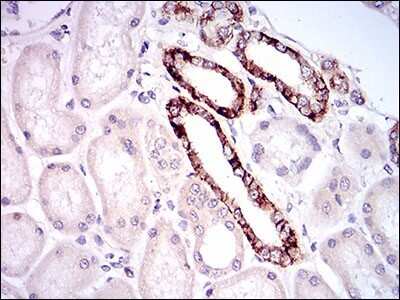 Immunohistochemistry: Tie-1 Antibody (8D12D2) - BSA Free [NBP2-37267]