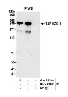 Immunoprecipitation: Tight Junction Protein 1 Antibody (BLR092G) [NBP2-80141]