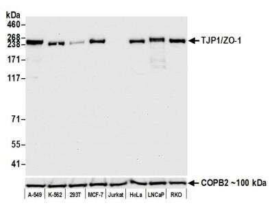 Western Blot: Tight Junction Protein 1 Antibody (BLR092G) [NBP2-80141]