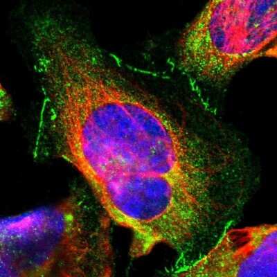 Immunocytochemistry/ Immunofluorescence: Tight Junction Protein 1 Antibody [NBP1-85047]
