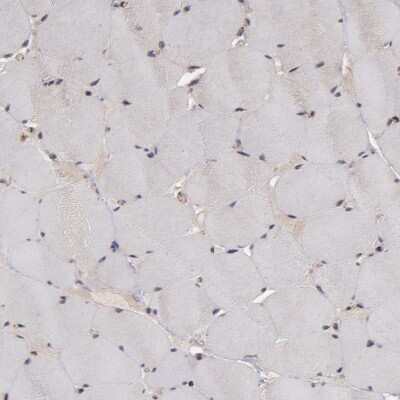 Immunohistochemistry-Paraffin: Tight Junction Protein 1 Antibody [NBP1-85046]