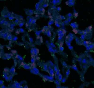 Immunocytochemistry/ Immunofluorescence: Tight Junction Protein 2 Antibody [NBP1-86850]