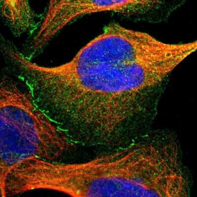 Immunocytochemistry/ Immunofluorescence: Tight Junction Protein 2 Antibody [NBP1-86850]