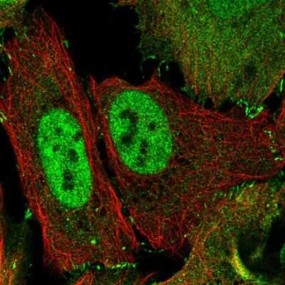 Immunocytochemistry/ Immunofluorescence: Tight Junction Protein 2 Antibody [NBP2-68905]