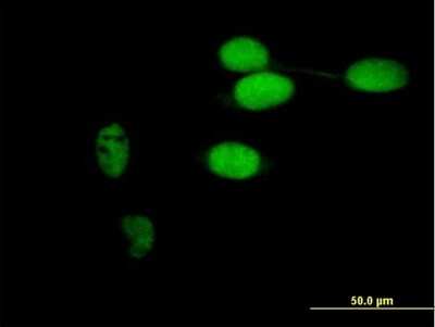 Immunocytochemistry/ Immunofluorescence: Timeless Antibody [H00008914-B01P]