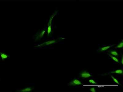 Immunocytochemistry/ Immunofluorescence: Timeless Antibody [H00008914-D01P]