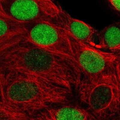 Immunocytochemistry/ Immunofluorescence: Timeless Antibody [NBP2-32559]