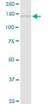 Western Blot: Timeless Antibody [H00008914-D01P]