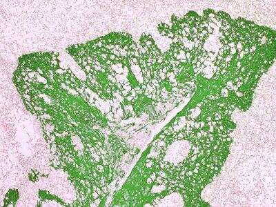 Immunohistochemistry-Paraffin: Tissue Glue Kit [NBP3-12174]